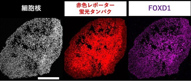 写真ニュース(2/5): ヒトiPS細胞から腎間質前駆細胞の選択的な分化誘導法を開発し糸球体メサンギウム構造を有する腎組織を体外で作製することに初めて成功 - BIGLOBEニュース