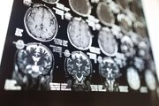 認知症のトリガーは｢老化｣と｢生活習慣病｣だけではない…65歳以上に発症リスクが急上昇する”意外な原因”