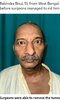 画像：後頭部からいびつな形の腫瘍が突き出していたインド西ベンガル州に住む51歳の男性。手術で7キロの腫瘍が切除された（『The Sun　「‘LIFE-CHANGING’ In…